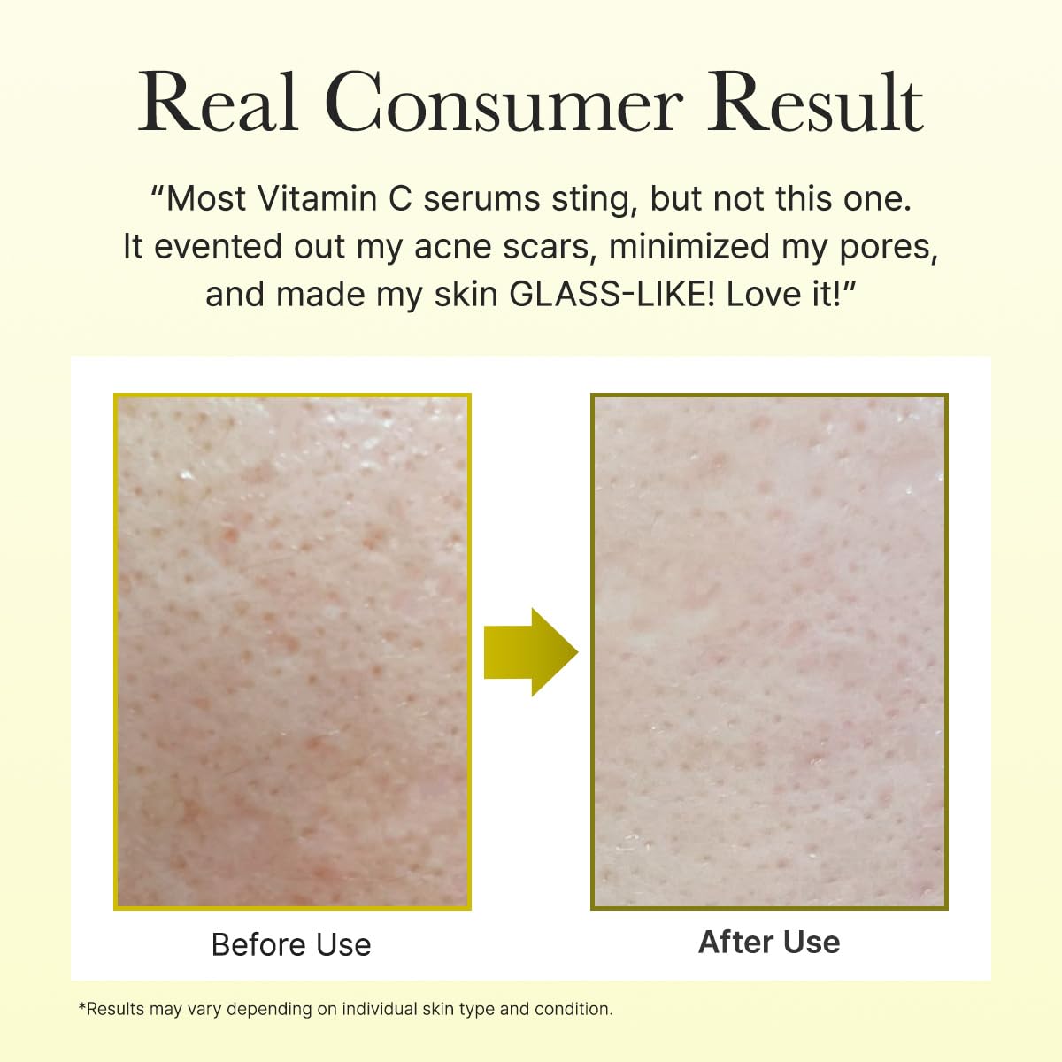 💥Black Friday Sale: Up to 49% Off 🔥Arencia Vitamin C Booster Serum with Glutathione, Niacinamide and Vitamin E for Glow Skin 1.01 fl oz