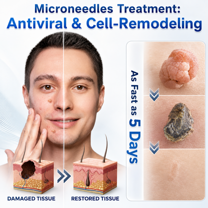 👩‍⚕️👪 𝐎𝐟𝐟𝐢𝐜𝐢𝐚𝐥 𝐒𝐭𝐨𝐫𝐞 | 𝑵𝐞𝒌𝐢𝐬𝐬® 🌿 𝐁𝐨𝐭𝐚𝐧𝐢𝐜𝐚𝐥 𝐌𝐢𝐜𝐫𝐨𝐧𝐞𝐞𝐝𝐥𝐞 𝐇𝐲𝐝𝐫𝐨𝐜𝐨𝐥𝐥𝐨𝐢𝐝 𝐏𝐚𝐭𝐜𝐡 (𝐅𝐨𝐫 𝐒𝐤𝐢𝐧 𝐓𝐚𝐠𝐬, 𝐒𝐦𝐚𝐥𝐥 𝐒𝐤𝐢𝐧 𝐆𝐫𝐨𝐰𝐭𝐡𝐬, 𝐖𝐚𝐫𝐭𝐬, 𝐌𝐨𝐥𝐞𝐬, 𝐀𝐠𝐞 𝐒𝐩𝐨𝐭𝐬 & 𝐏𝐢𝐠𝐦𝐞𝐧𝐭𝐚𝐭𝐢𝐨𝐧 𝐂𝐨𝐧𝐜𝐞𝐫𝐧𝐬)