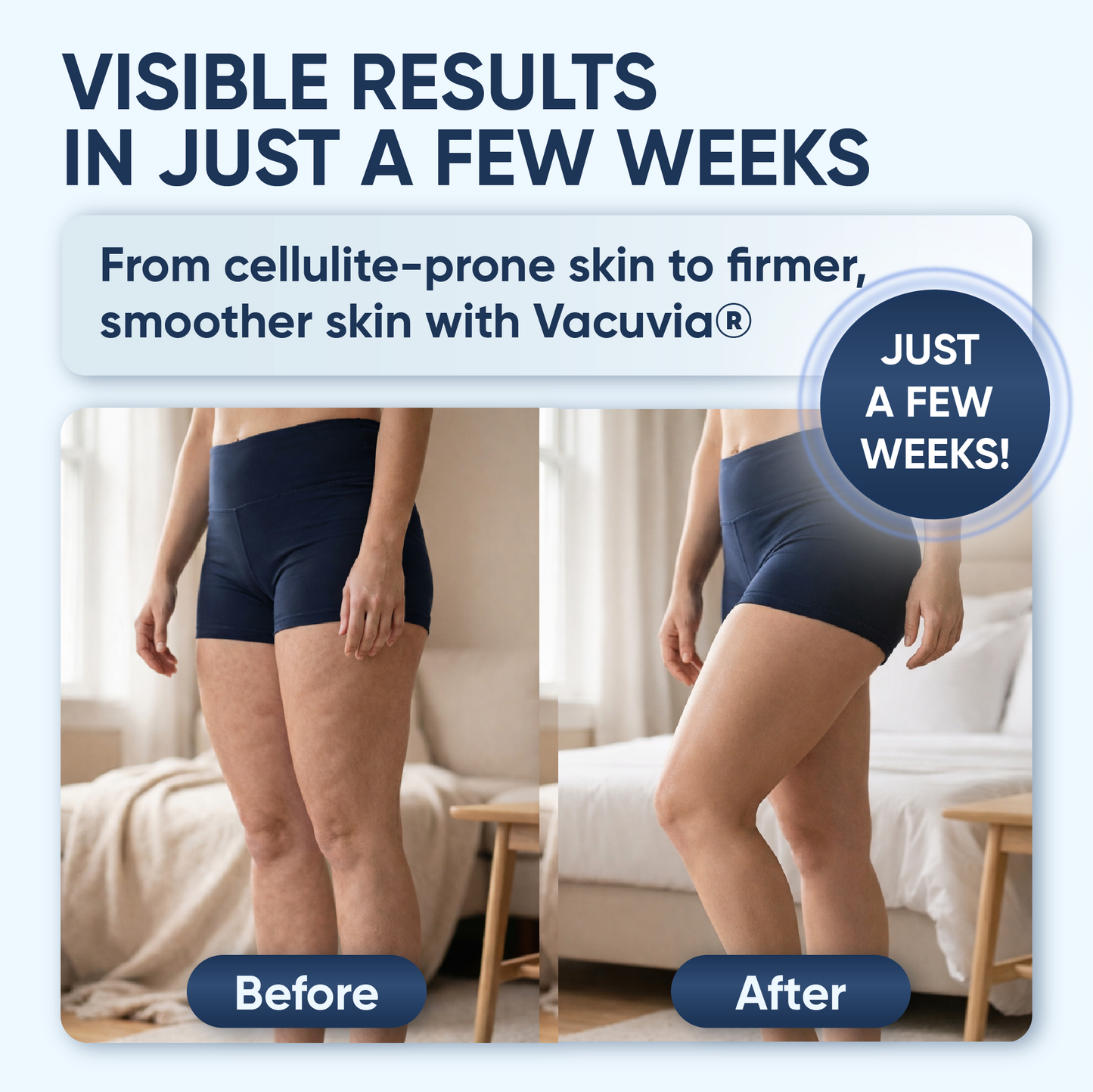 Vacuvia SculptGlow Firmer, More Toned Skin
